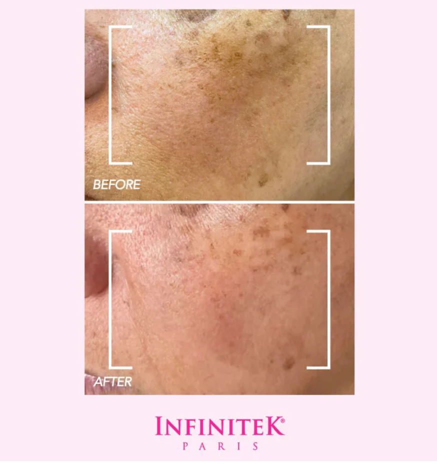 Brightening Facial Serum. Targets dark spots and reduces visible signs of aging